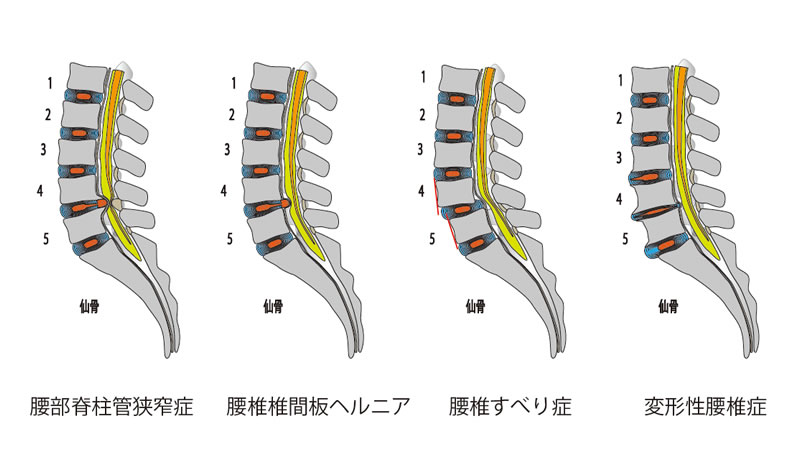 肩　股関節　膝　脊椎のスポーツリハビリテーション【電子版付】